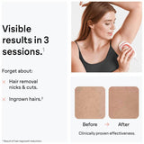 Braun Silk Expert Mini IPL device for home hair removal, UK version