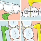 Tepe Angle Interdental Brush Pink Oral Care Tool (British brand)