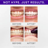 Hismile V34 whitening strips 14pk, UK version
