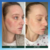 Sorted Skin Intensive Rescue Face Lotion with Microbiome Prebiotic 50ml (British brand)