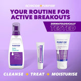 Acnecide spot treatment gel with benzoyl peroxide 15g - British product