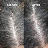 Umberto Giannini Scalp Restore Kit 3 x 50ml (British brand)