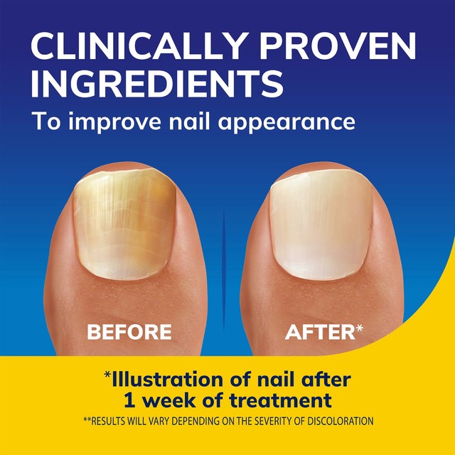 Dr Scholl's Nail Revitaliser Serum - British product