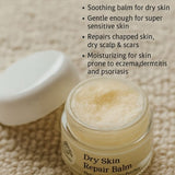 Ovviovita Dry Skin Repair Ayurvedic Balm 50ml, imported from the UK