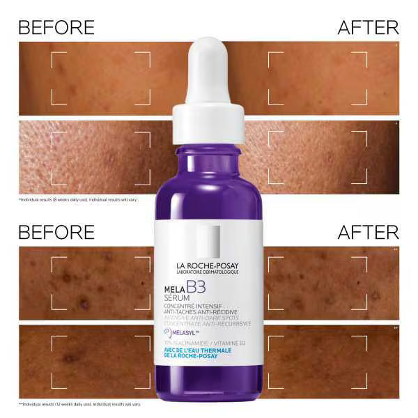 La Roche-Posay MelaB3 Anti-Dark Spot Serum 30ml, UK version
