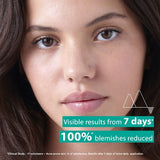 Uriage Hyséac anti-blemish serum 40ml (British brand)