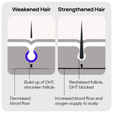 Sons hair regrowth Minoxidil 5% spray 3-month supply, imported from the UK