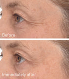 Murad Retinol Youth Renewal Eye Mask Pack of 5, imported from the UK