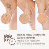 Philips Lumea 9900 IPL hair removal - British product