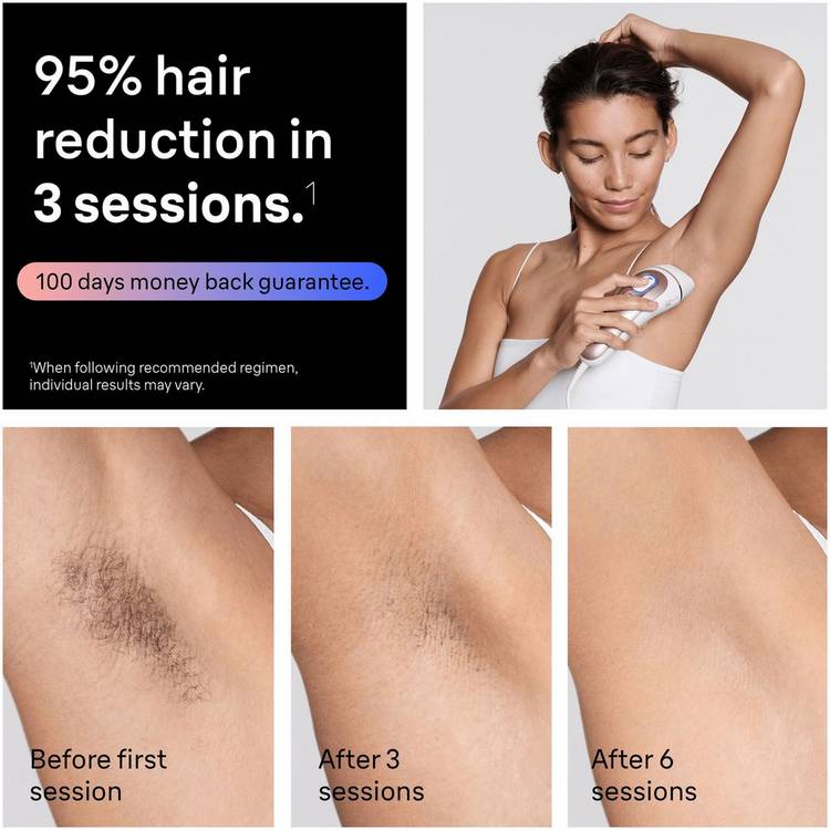 Braun PL7211 IPL hair removal device, UK version