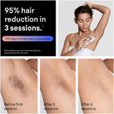 Braun PL7211 IPL hair removal device, UK version