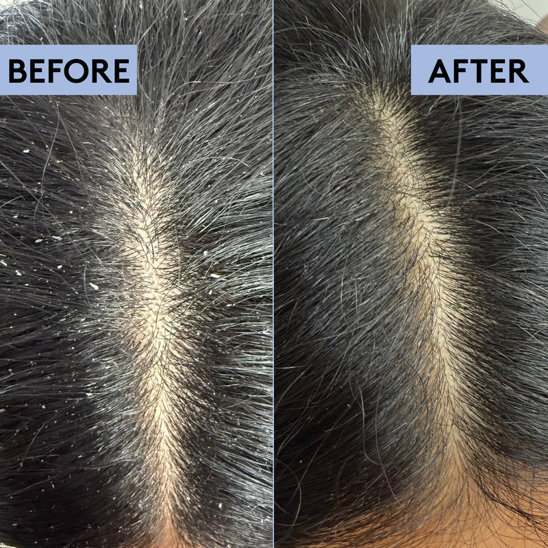 Scalp-Eaze Exfoliate & Clarify scalp scrub, UK version