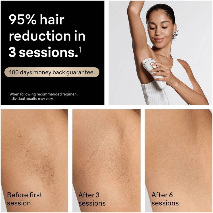 Braun IPL hair removal device PL5221 corded, UK version
