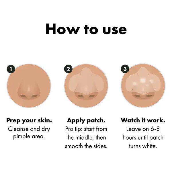 Hero Nose Hydrocolloid Patches 10 Count, UK version