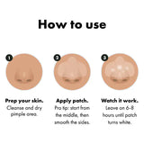 Hero Nose Hydrocolloid Patches 10 Count, UK version