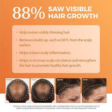 BosleyMD BOSRevive nourishing shampoo 300ml - British product