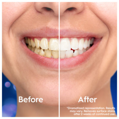 Oral-B 3D White Clinical toothpaste 75ml, imported from the UK
