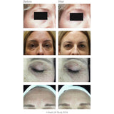 Rio Facelite LED face mask for red light therapy - British product