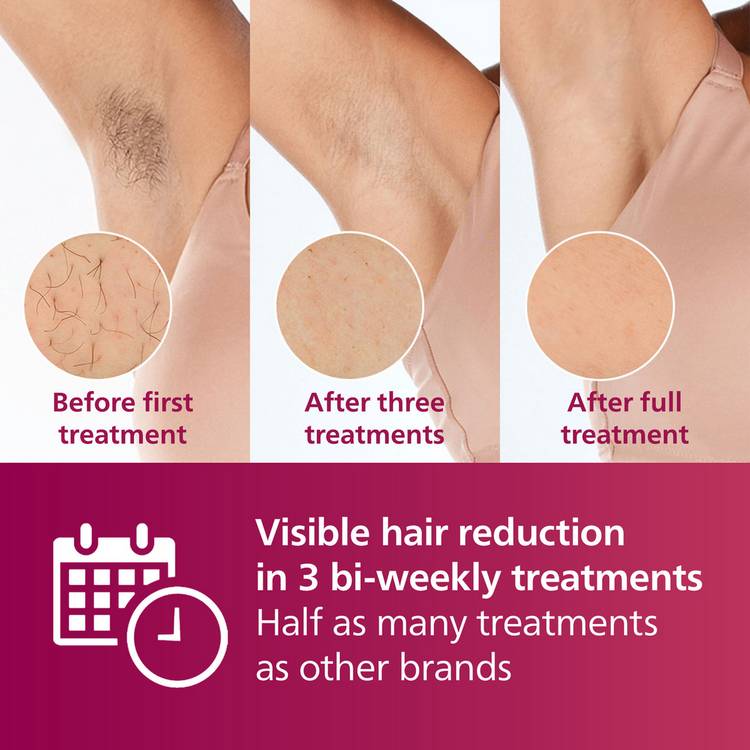 Philips Lumea Series 7000 IPL hair removal - British product