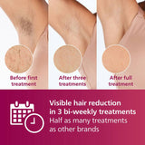 Philips Lumea Series 7000 IPL hair removal - British product