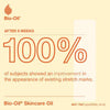 Bio-Oil Skincare Oil Scars Stretch Marks 125ml - British product