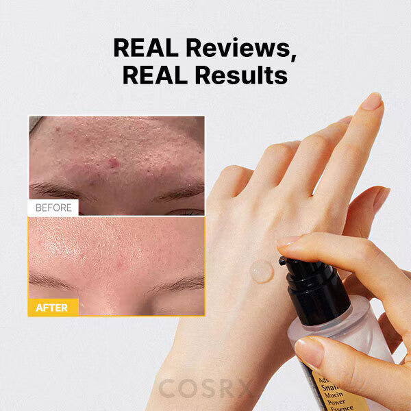 Cosrx Advanced Snail Mucin Essence 100Ml - British product