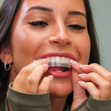 Whites Beaconsfield teeth whitening strips 14 day treatment, imported from the UK