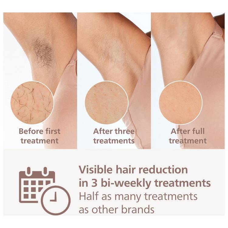 Philips IPL hair removal device Series 8000 BRI947/00, UK version