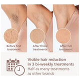 Philips IPL hair removal device Series 8000 BRI947/00, UK version