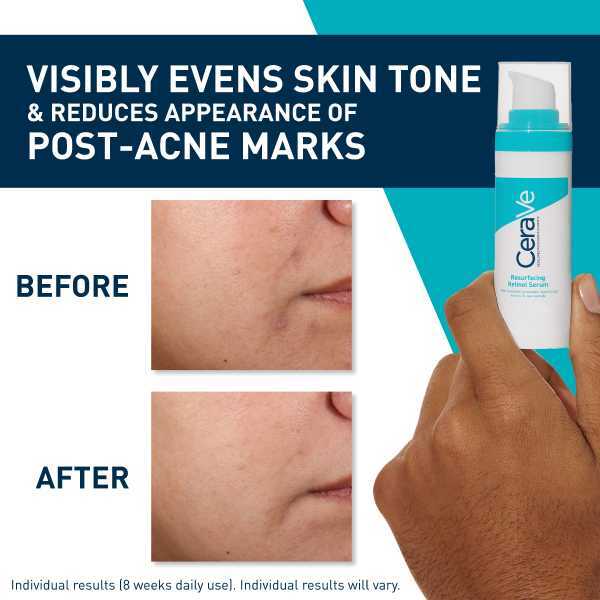 CeraVe Retinol Serum with Niacinamide 30ml - British product