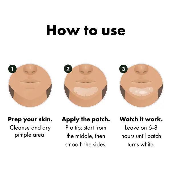 Hero Mighty Patch chin acne patches 10 count, UK version