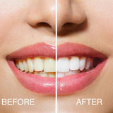 Rio teeth whitening advanced blue light kit, imported from the UK
