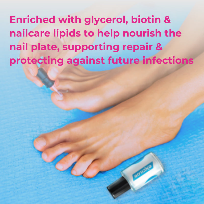 Excilor Ultra nail fungus solution 30ml, imported from the UK