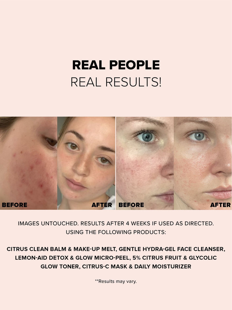 NUDESTIX Nudeskin Gentle Hydragel Face Cleanser 70ml, imported from the UK