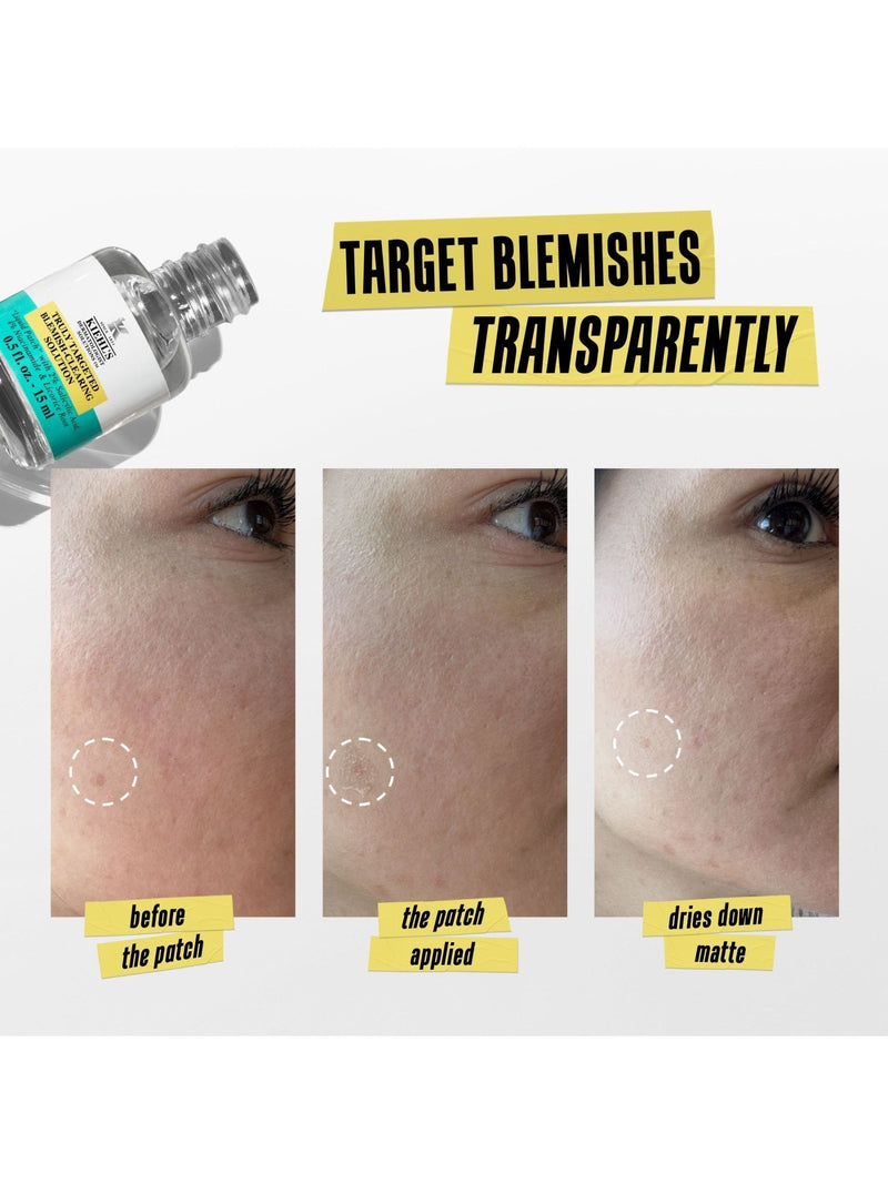 Kiehls Blemish Clearing Solution Moisturiser 15ml, UK version