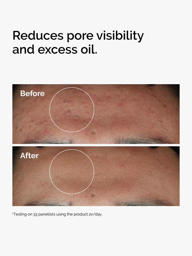 The Ordinary Niacinamide Serum 10% + Zinc 1% 60ml (British brand)