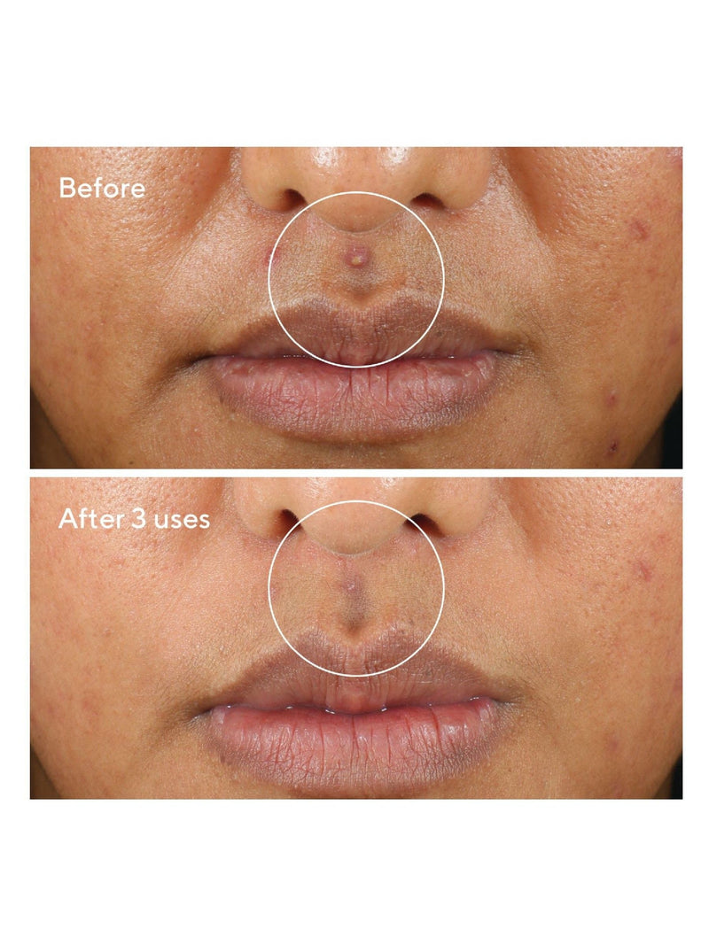 Murad Rapid Relief Sulfur Mask 75ml, imported from the UK