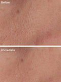 Murad Targeted Pore Corrector serum 15ml, imported from the UK