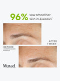 Murad Replenishing Multi Acid Peel 100ml, imported from the UK