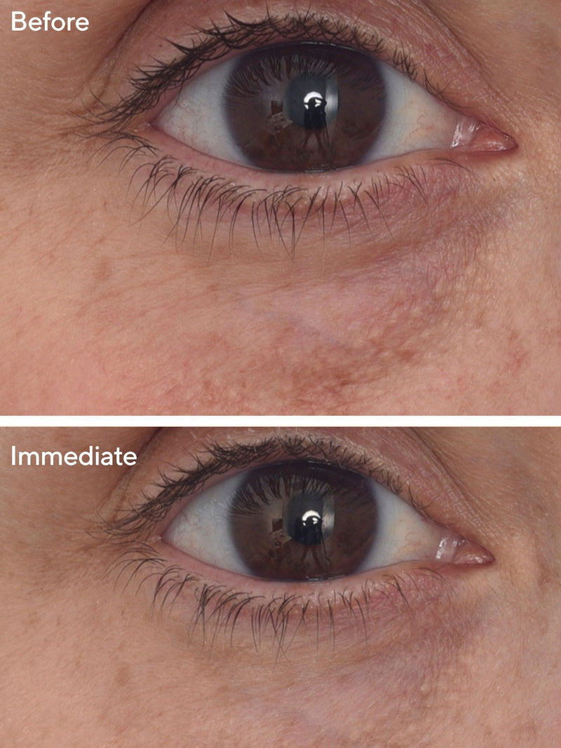 Murad Targeted Eye Depuffer eye treatment 15ml, imported from the UK