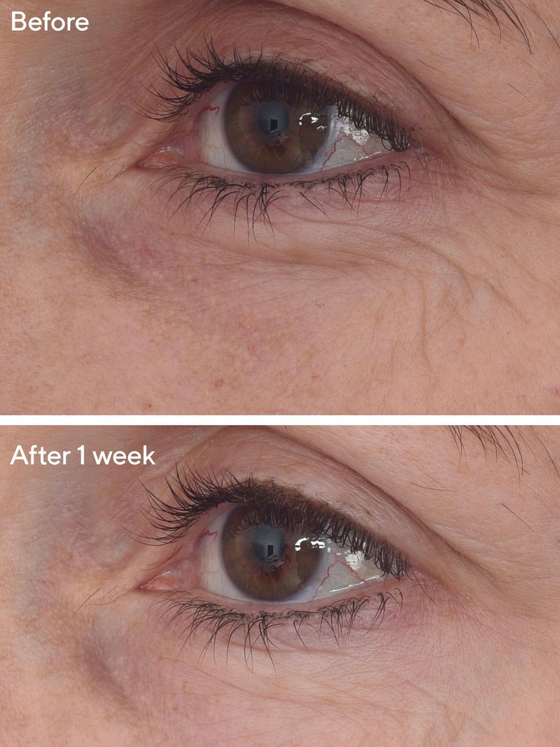 Murad Retinal ReSculpt Eye Treatment, imported from the UK