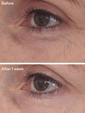 Murad Retinal ReSculpt Eye Treatment, imported from the UK
