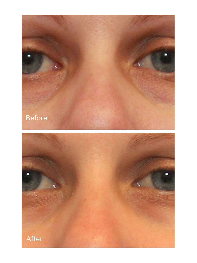 Murad Vita-C Eyes Dark Circle Corrector Serum 15ml, imported from the UK