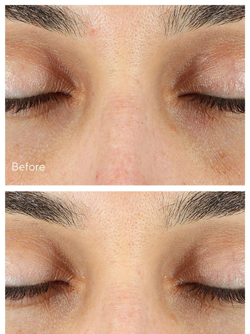 Murad Vita-C Eyes Dark Circle Corrector Serum 15ml, imported from the UK