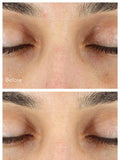 Murad Vita-C Eyes Dark Circle Corrector Serum 15ml, imported from the UK