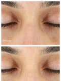 Murad Vita-C Eyes Dark Circle Corrector Serum 15ml, imported from the UK