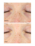 Murad Vita-C Eyes Dark Circle Corrector Serum 15ml, imported from the UK