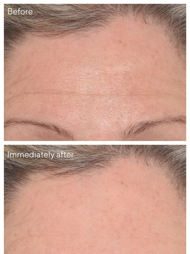 Murad targeted wrinkle corrector 15ml, imported from the UK