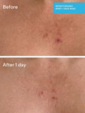 Murad Retexturizing Body + Face Pads (British brand)
