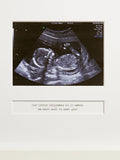 Posh Totty Designs Personalised My First Scan photo frame 25cm x 25cm, imported from the UK